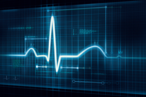Cardiomatics 为其心电图读取 AI 筹集了 320 万美元