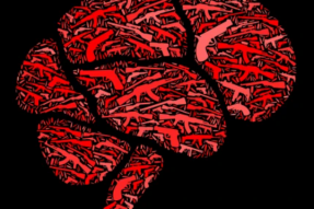 是时候结束脑部创伤性部队在家中的战争了